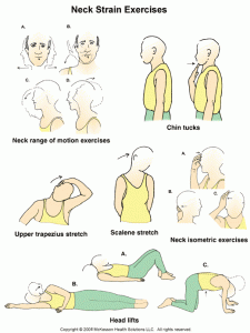 Neck-Strain-Exercises Osteopath