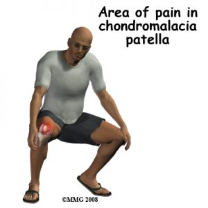 knee pain. osteopathy