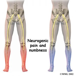lumbar_low_back_pain_Kettering Osteopath