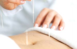 Acupuncture for Overactive Bladder