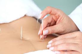 Acupuncture and Chinese Herbal Medicine in Kettering Northamptonshire
