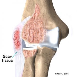 elbow Osteopath