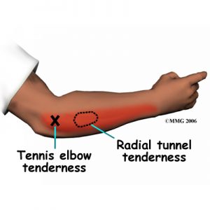 elbow Osteopath