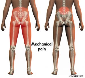 lumbar_low_back_pain_Kettering Osteopath