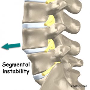 lumbar_low_back_pain_Kettering Osteopath