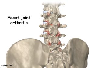 lumbar_low_back_pain_Kettering Osteopath