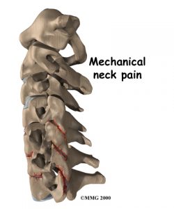 neck_pain. Kettering Osteopath
