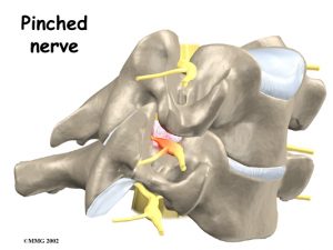 neck_pain. Kettering Osteopath